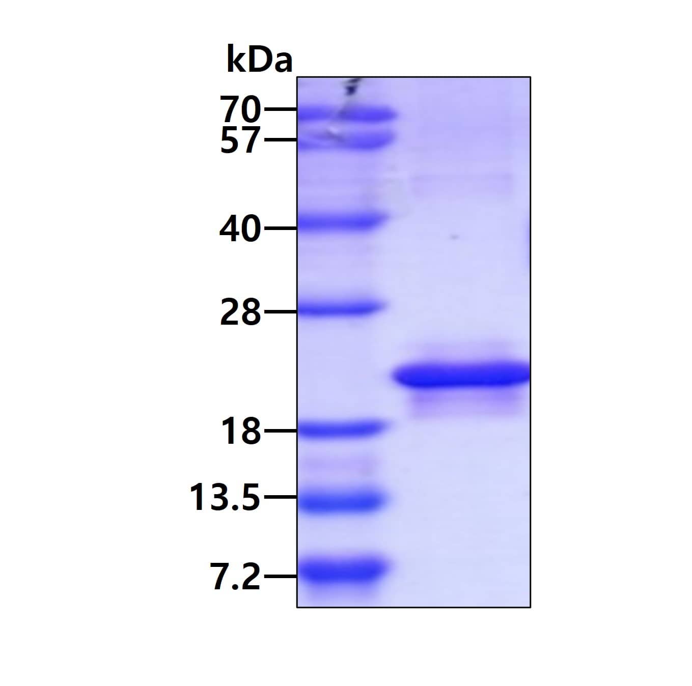 Recombinant Human MOSPD1 His Protein