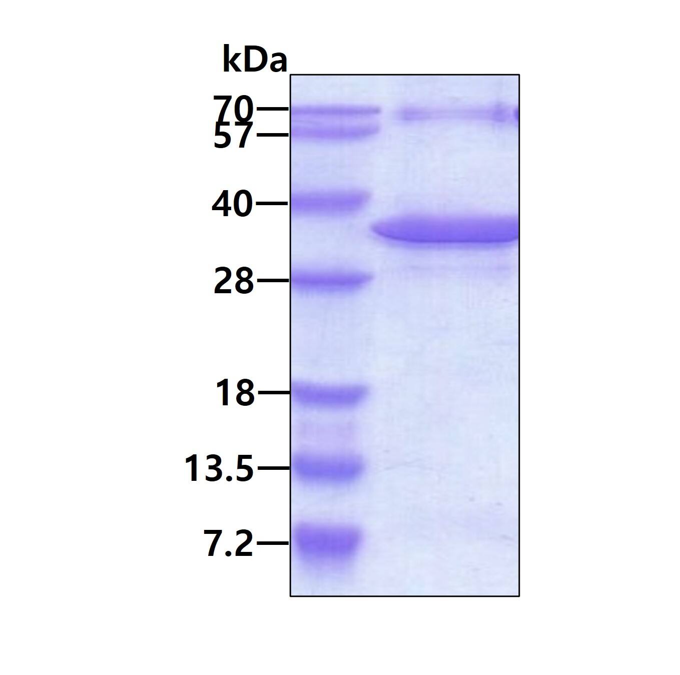 Recombinant Human NFU1 iron-sulfur cluster scaffold homolog His Protein SDS-Page: NFU1 iron-sulfur cluster scaffold homolog (S. cerevisiae) Recombinant Protein [NBP2-51897]