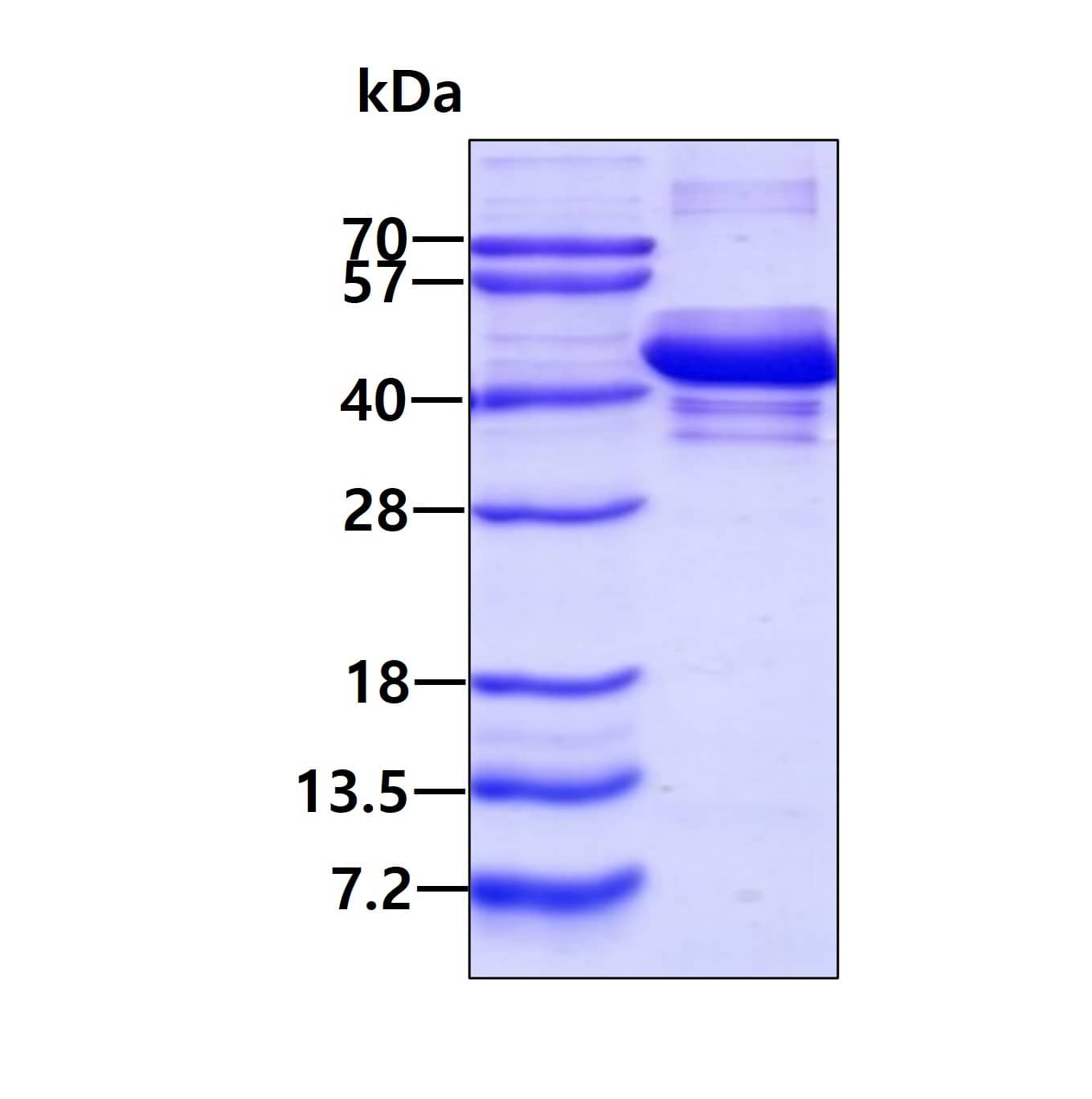 Recombinant Human SH3GL3 His Protein