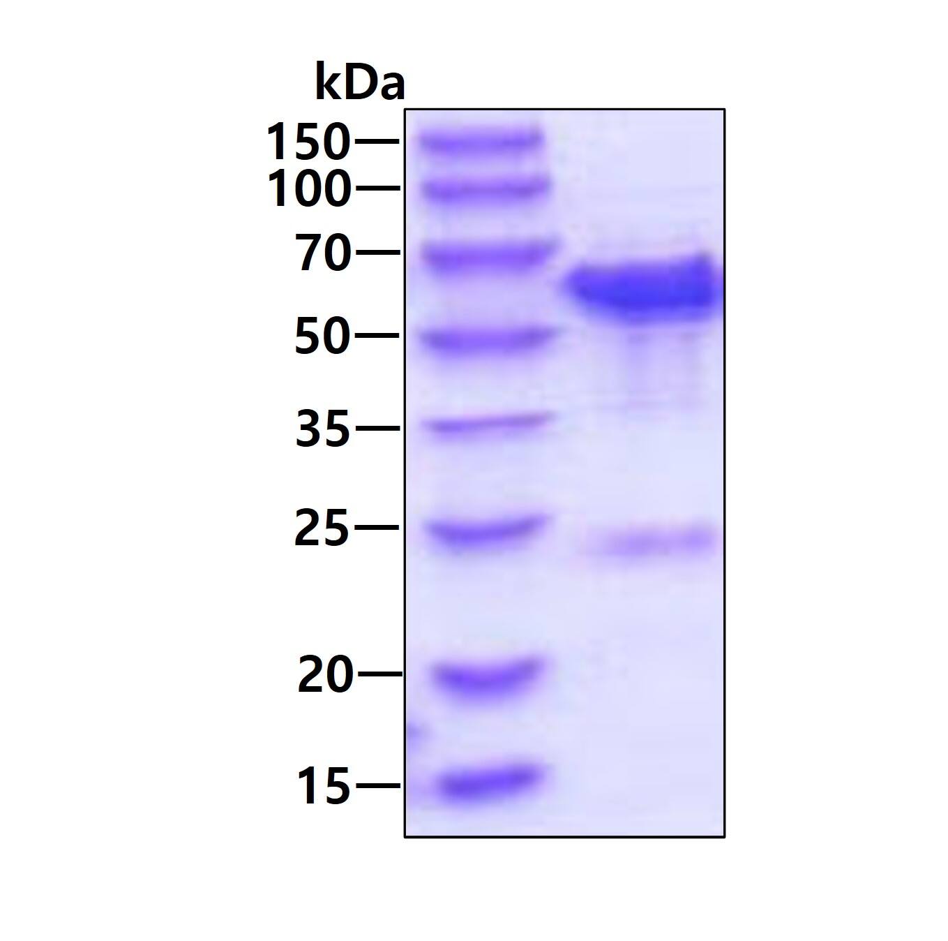 Recombinant Human TBC1D22B His Protein