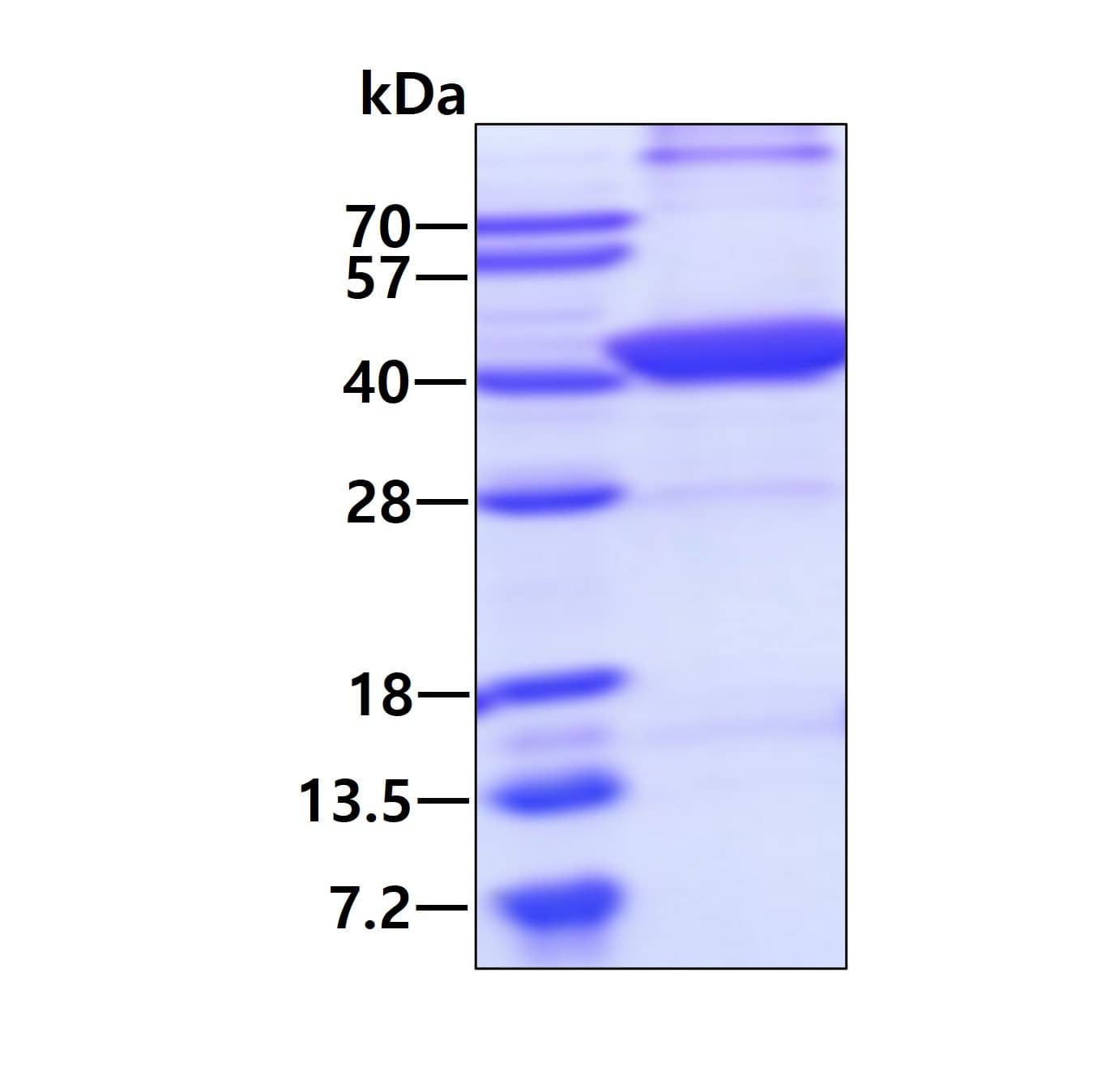 Recombinant Human FBPase 1 His Protein