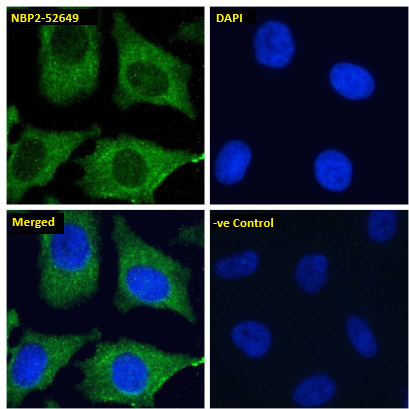 DC-SIGNR/CD299/CLEC4M Antibody (16E7) - Chimeric - Azide and BSA Free