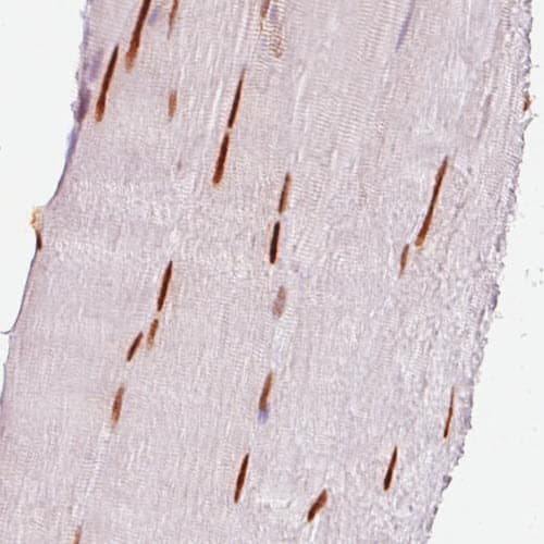 SIX1 Antibody (CL0185) - BSA Free Immunohistochemistry-Paraffin: SIX1 Antibody (CL0185) [NBP2-52873]
