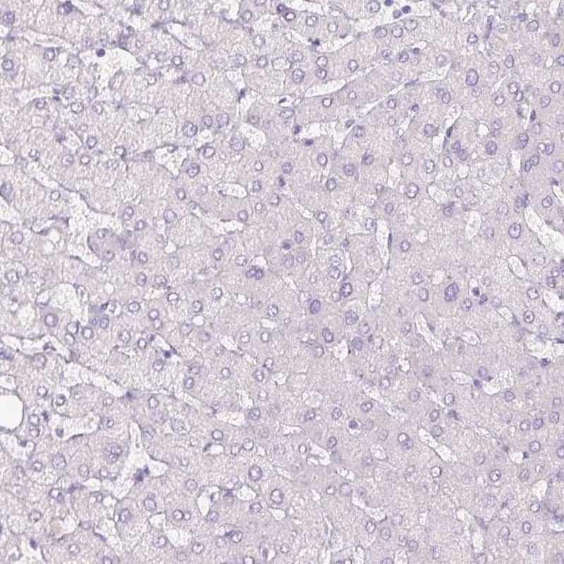 SIX1 Antibody (CL0185) - BSA Free Immunohistochemistry-Paraffin: SIX1 Antibody (CL0185) [NBP2-52873]