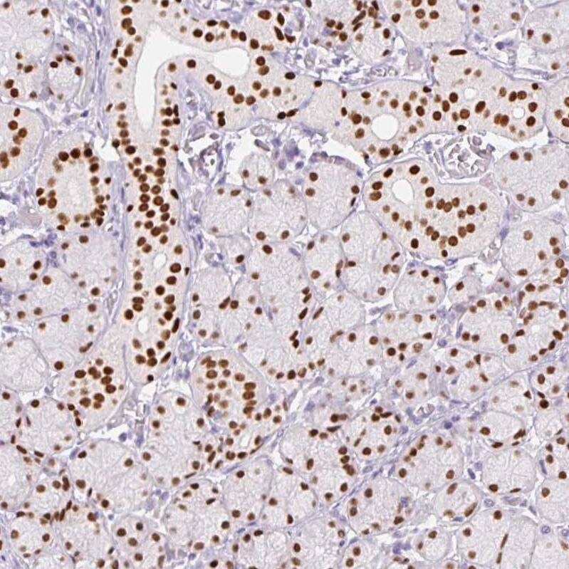 SIX1 Antibody (CL0185) - BSA Free Immunohistochemistry-Paraffin: SIX1 Antibody (CL0185) [NBP2-52873]