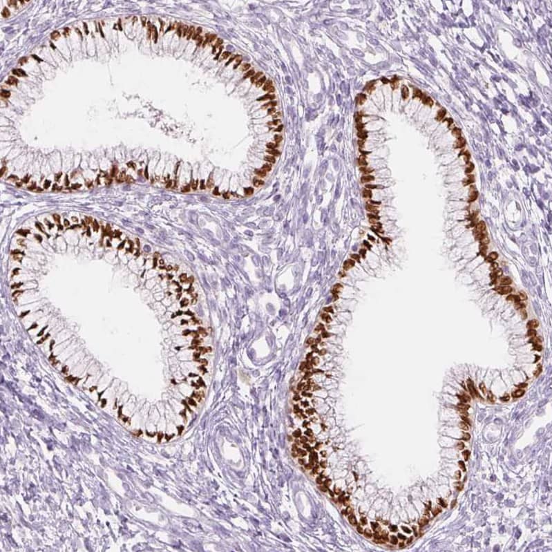 SIX1 Antibody (CL0185) - BSA Free Immunohistochemistry-Paraffin: SIX1 Antibody (CL0185) [NBP2-52873]