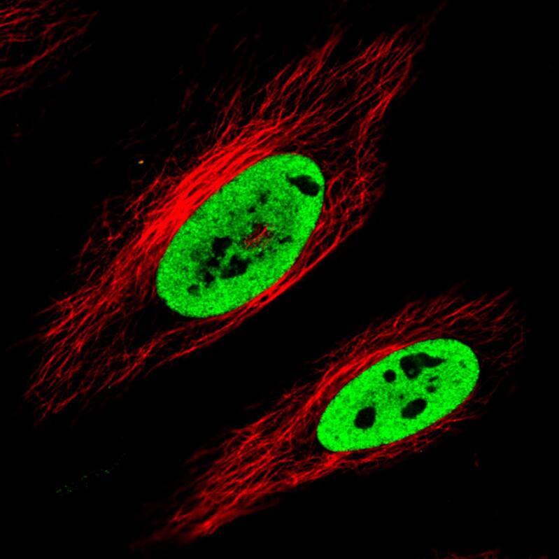 FUS Antibody (CL0190) - BSA Free Immunocytochemistry/ Immunofluorescence: FUS Antibody (CL0190) [NBP2-52874]