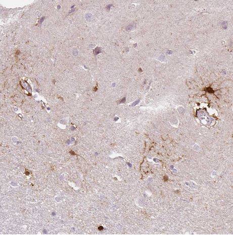 FABP7/B-FABP Antibody (CL0236) FABP7/B-FABP Antibody (CL0236)