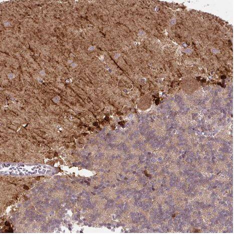 FABP7/B-FABP Antibody (CL0236) FABP7/B-FABP Antibody (CL0236)