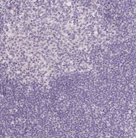 FABP7/B-FABP Antibody (CL0236) FABP7/B-FABP Antibody (CL0236)