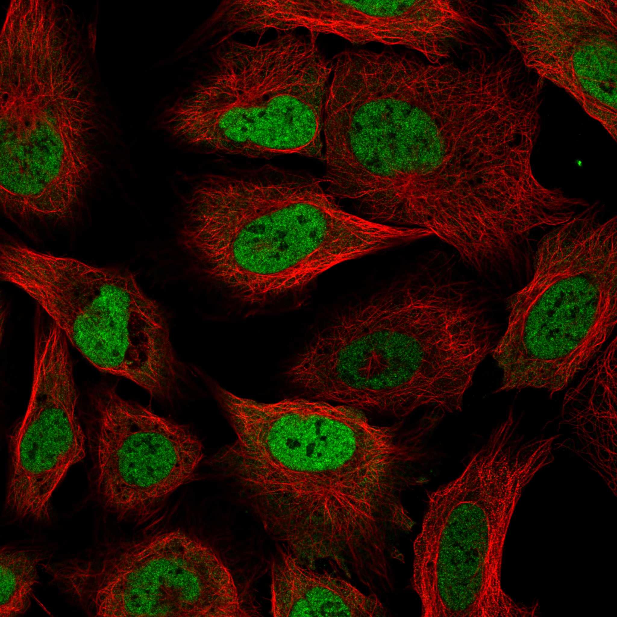 RBM3 Antibody (CL0296) - BSA Free Immunocytochemistry/ Immunofluorescence: RBM3 Antibody (CL0296) [NBP2-52906]