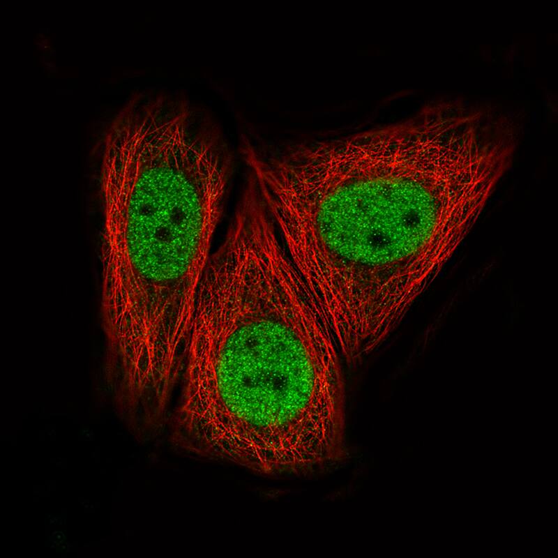 CTCF Antibody (CL0307) - BSA Free Immunocytochemistry/ Immunofluorescence: CTCF Antibody (CL0307) [NBP2-52911]