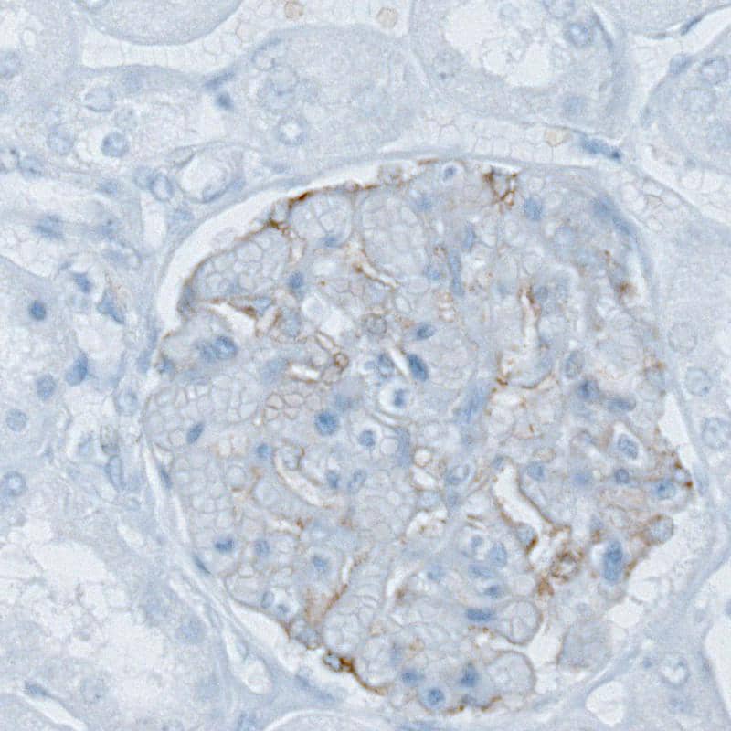 PLA2R1 Antibody (CL0474) - BSA Free Immunohistochemistry-Paraffin: PLA2R1 Antibody (CL0474) [NBP2-52933]