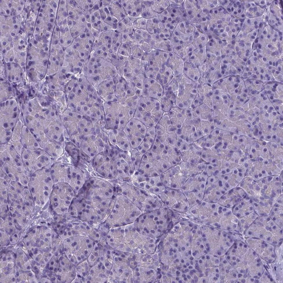 PLA2R1 Antibody (CL0474) - BSA Free Immunohistochemistry-Paraffin: PLA2R1 Antibody (CL0474) [NBP2-52933]