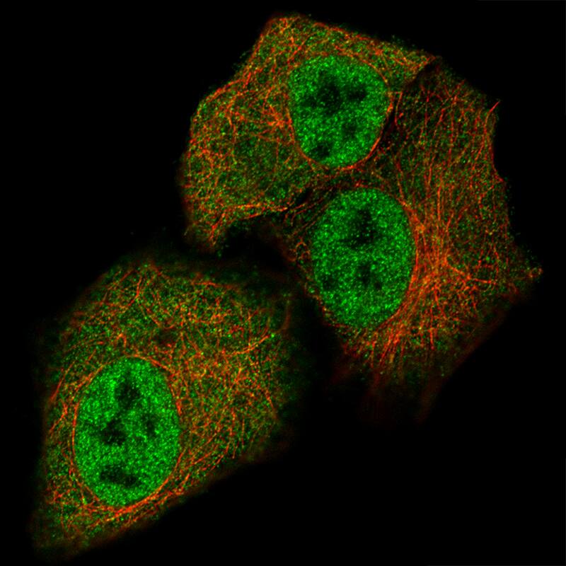 STAT3 Antibody (CL0492) - BSA Free Immunocytochemistry/ Immunofluorescence: STAT3 Antibody (CL0492) [NBP2-52936]