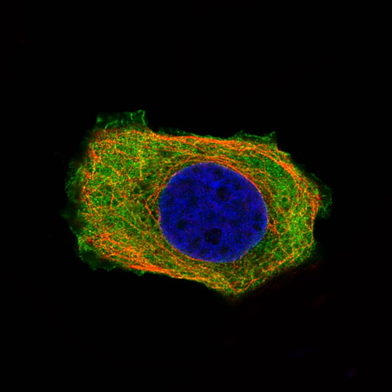 PHGDH Antibody (CL0555) - BSA Free Immunocytochemistry/ Immunofluorescence: PHGDH Antibody (CL0555) [NBP2-52939] -