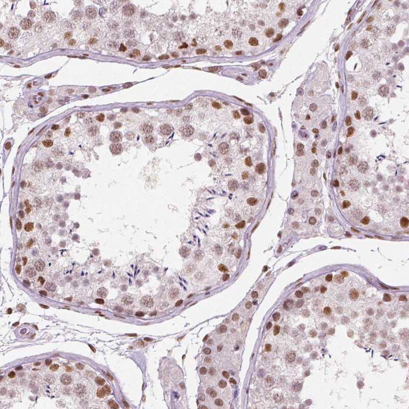 BRD4 Antibody (CL1115) - BSA Free Immunohistochemistry: BRD4 Antibody (CL1115) [NBP3-52453]