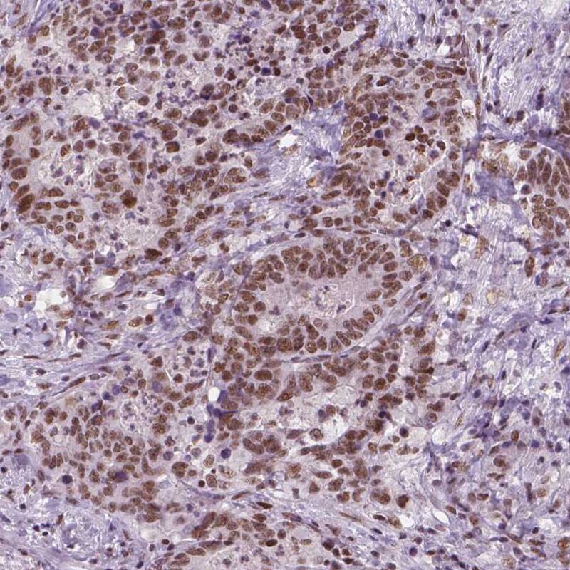 BRD4 Antibody (CL1115) - BSA Free Immunohistochemistry: BRD4 Antibody (CL1115) [NBP3-52453]