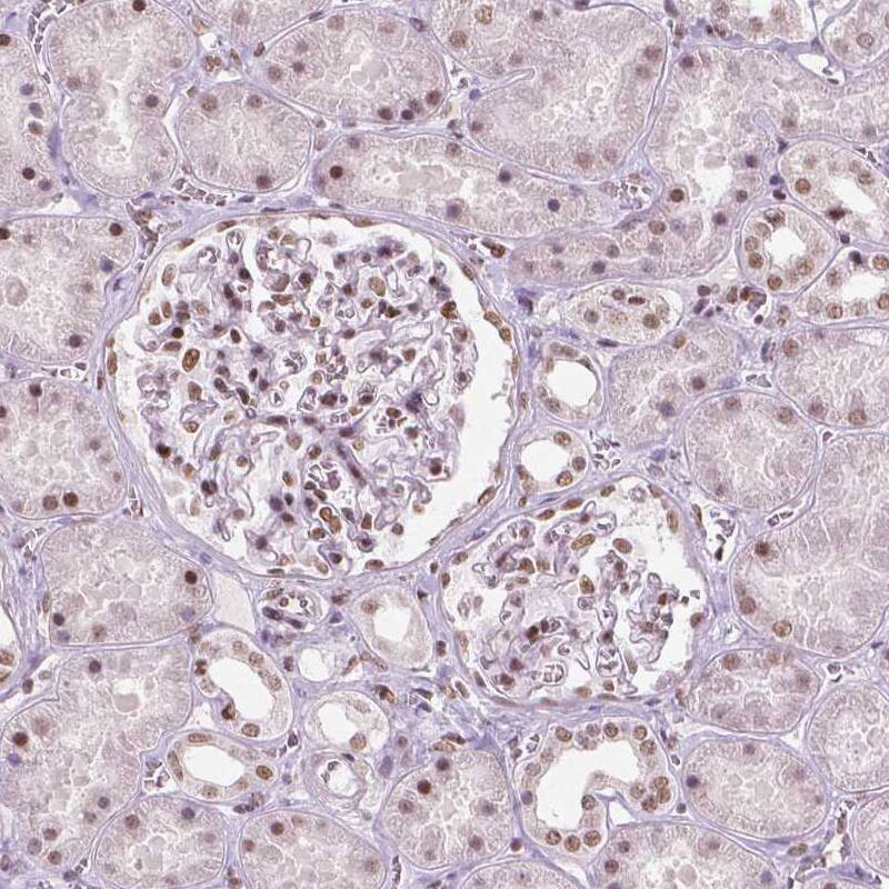 BRD4 Antibody (CL1115) - BSA Free Immunohistochemistry: BRD4 Antibody (CL1115) [NBP3-52453]