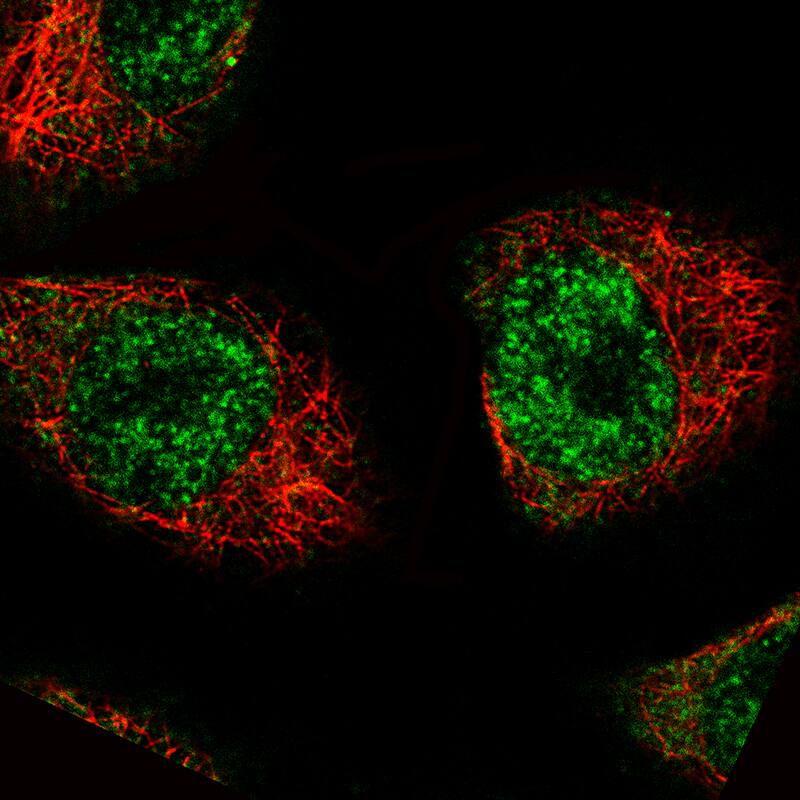 MKL2 Antibody (CL1546) - BSA Free Immunocytochemistry/ Immunofluorescence: MKL2 Antibody (CL1546) [NBP2-52970]