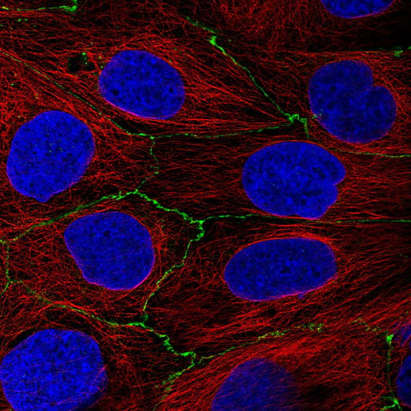 Occludin Antibody (CL1555) - BSA Free Immunocytochemistry/ Immunofluorescence: Occludin Antibody (CL1555) [NBP2-52971]