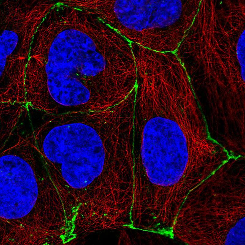 Occludin Antibody (CL1567) - BSA Free Immunocytochemistry/ Immunofluorescence: Occludin Antibody (CL1567) [NBP2-52972]