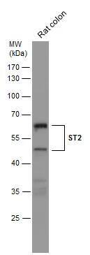 ST2/IL-33R Antibody - BSA Free