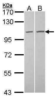 TUBGCP2 Antibody - BSA Free