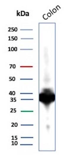 Calponin 1 Antibody (CNN1/1408R) Western Blot: Calponin 1 Antibody (CNN1/1408R) [NBP2-53233] -