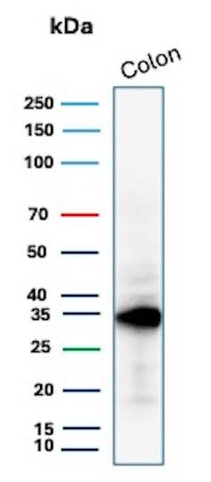 Calponin 1 Antibody (CNN1/1408R) Western Blot: Calponin 1 Antibody (CNN1/1408R) [NBP2-53233] -