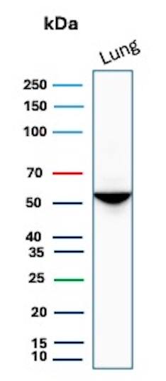 Serpin A1/alpha 1-Antitrypsin Antibody (AAT/1379) Western Blot: Serpin A1/alpha 1-Antitrypsin Antibody (AAT/1379) [NBP2-53302] -