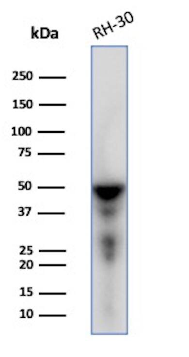 Desmin Antibody (DES/1711) Western Blot: Desmin Antibody (DES/1711) [NBP2-53383] -