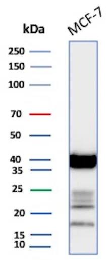 EpCAM/TROP1 Antibody (EGP40/1555R) - (ECD) - Azide and BSA Free Western Blot: EpCAM/TROP1 Antibody (EGP40/1555R) - (ECD) - Azide and BSA Free [NBP2-54424] -