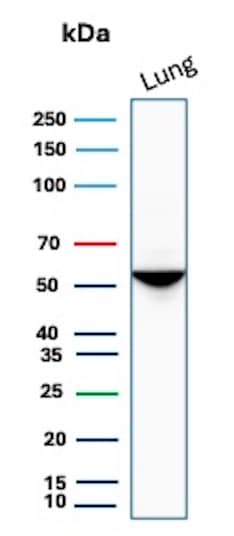 Serpin A1/alpha 1-Antitrypsin Antibody (AAT/1379) - Azide and BSA Free Western Blot: Serpin A1/alpha 1-Antitrypsin Antibody (AAT/1379) - Azide and BSA Free [NBP2-54442] -