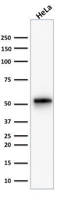 Negative Control for Rabbit Monoclonal Antibody (NCRBM/1520R) - Azide and BSA Free Western Blot: Negative Control for Rabbit Monoclonal Antibody (NCRBM/1520R) - Azide and BSA Free [NBP2-54471] -