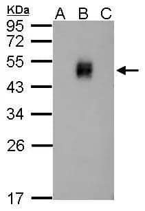 Dengue Virus NS1 protein Antibody - BSA Free