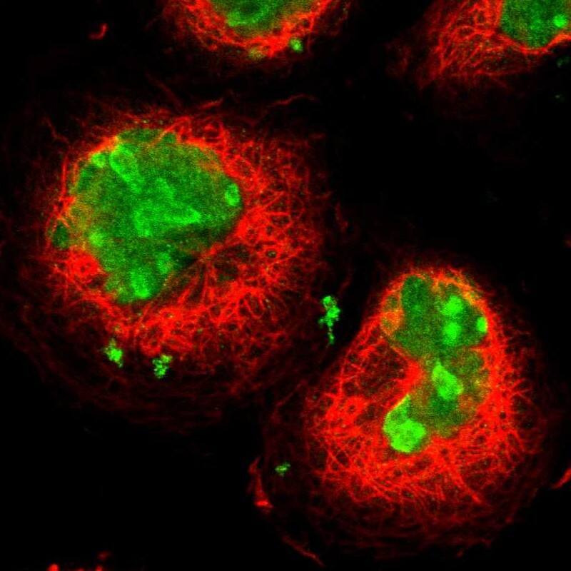 Ki67/MKI67 Antibody - BSA Free Immunocytochemistry/ Immunofluorescence: Ki67/MKI67 Antibody [NBP2-54656]