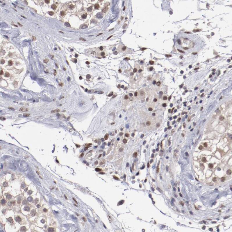 ARNT/HIF-1 beta Antibody - BSA Free Immunohistochemistry-Paraffin: ARNT/HIF-1 beta Antibody [NBP2-54663]