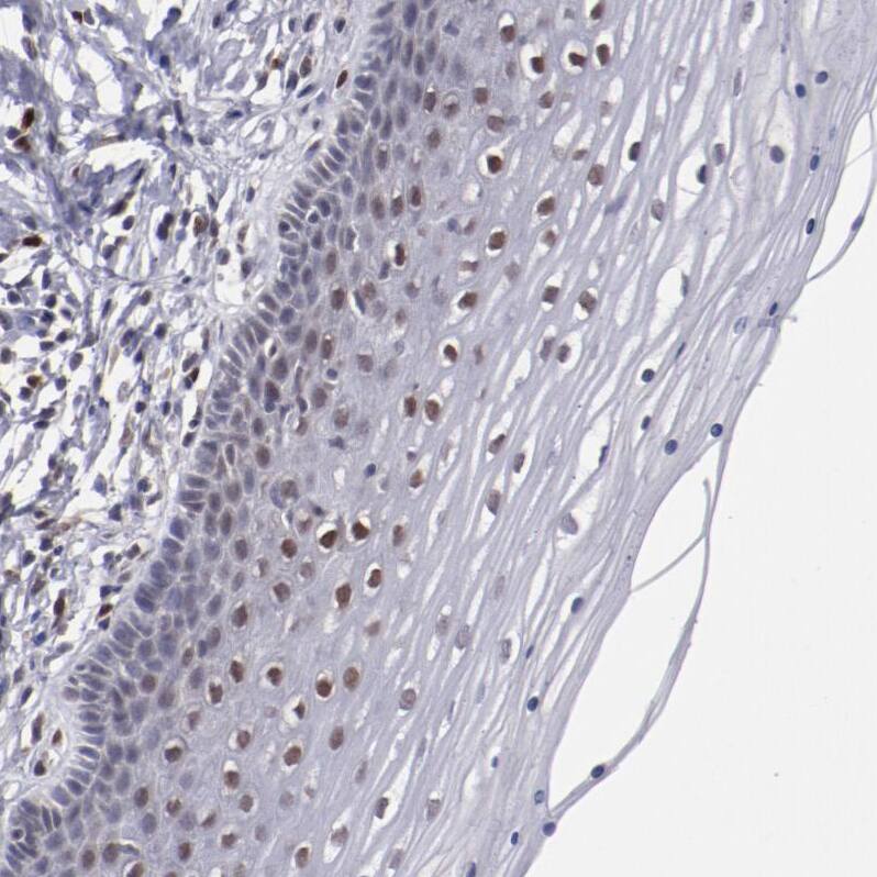ARNT/HIF-1 beta Antibody - BSA Free Immunohistochemistry-Paraffin: ARNT/HIF-1 beta Antibody [NBP2-54663]