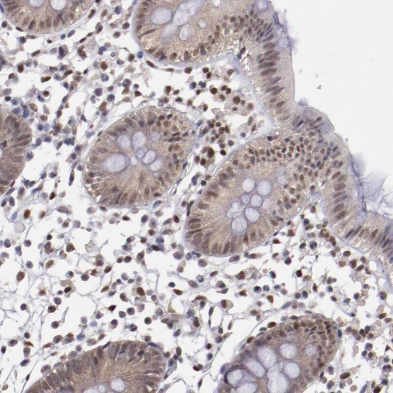 ARNT/HIF-1 beta Antibody - BSA Free Immunohistochemistry-Paraffin: ARNT/HIF-1 beta Antibody [NBP2-54663]