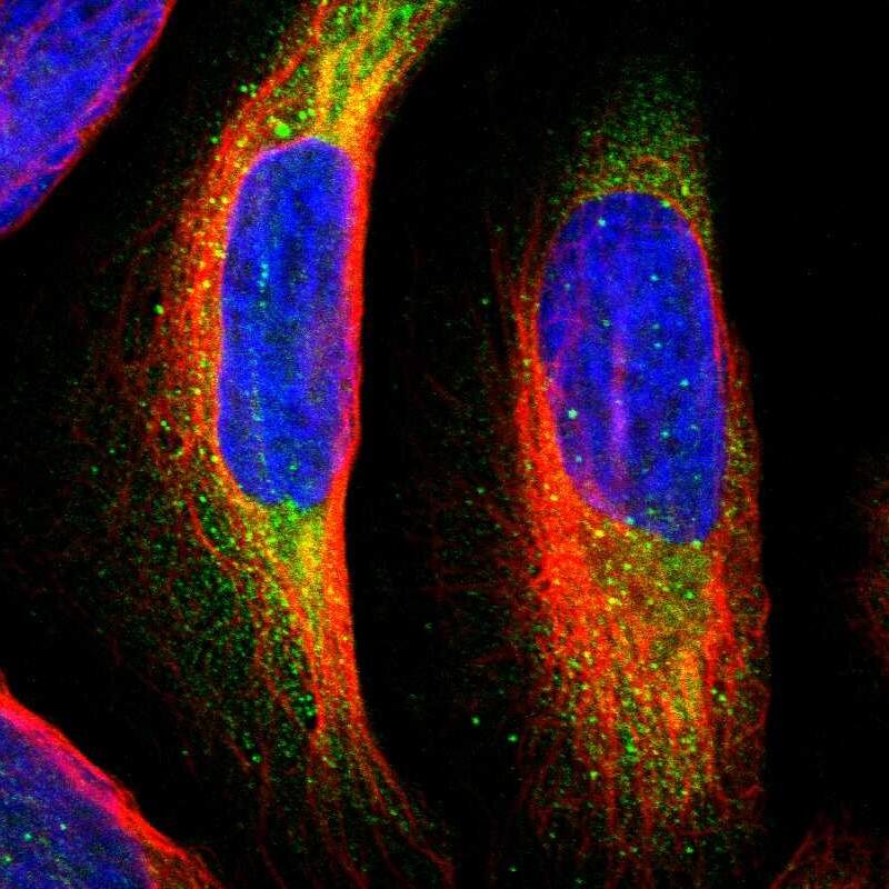 MTH1 Antibody - BSA Free Immunocytochemistry/ Immunofluorescence: MTH1 Antibody [NBP2-54664]