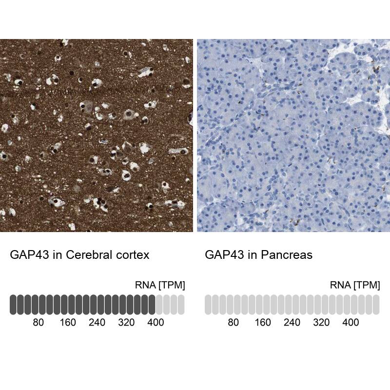 GAP-43 Antibody - BSA Free Immunohistochemistry-Paraffin: GAP-43 Antibody [NBP2-54671]