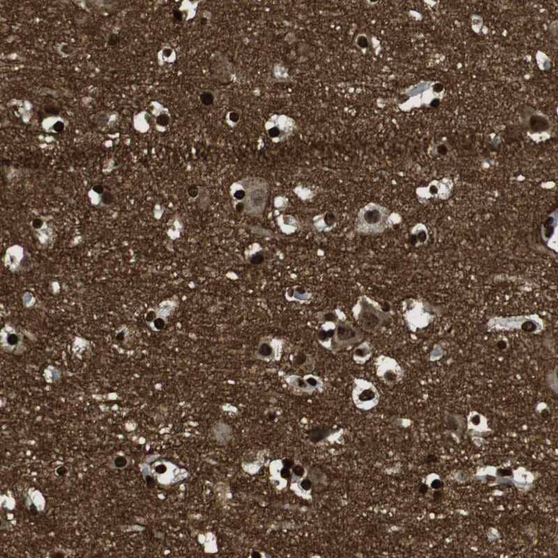 GAP-43 Antibody - BSA Free Immunohistochemistry-Paraffin: GAP-43 Antibody [NBP2-54671]