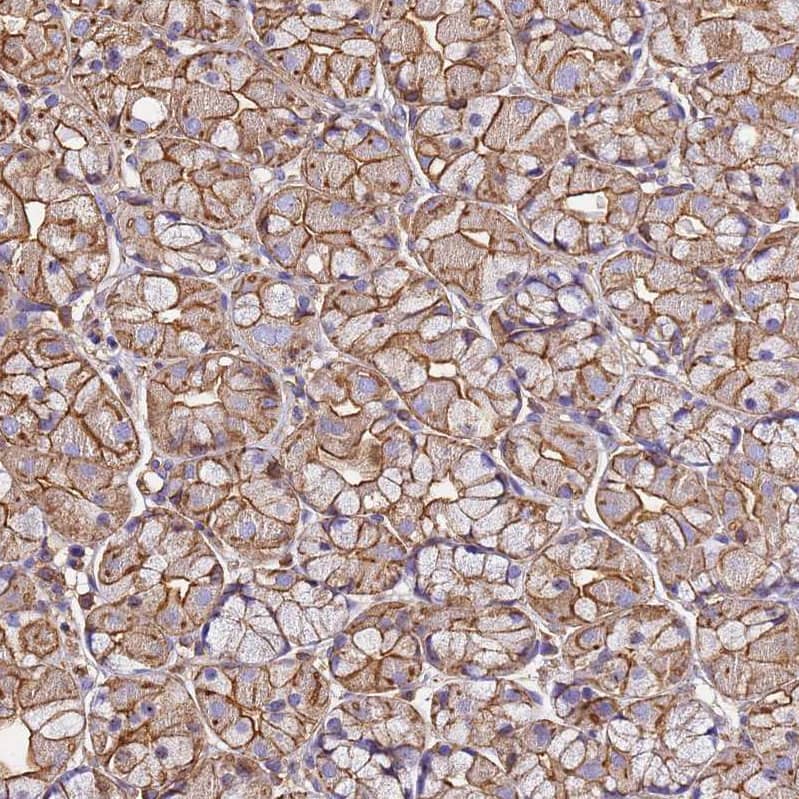 beta-Actin Antibody - BSA Free Immunohistochemistry-Paraffin: beta-Actin Antibody [NBP2-54690]