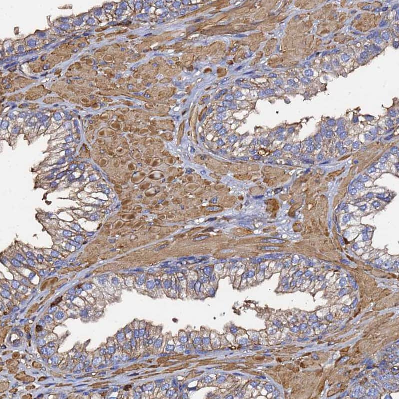 beta-Actin Antibody - BSA Free Immunohistochemistry-Paraffin: beta-Actin Antibody [NBP2-54690]