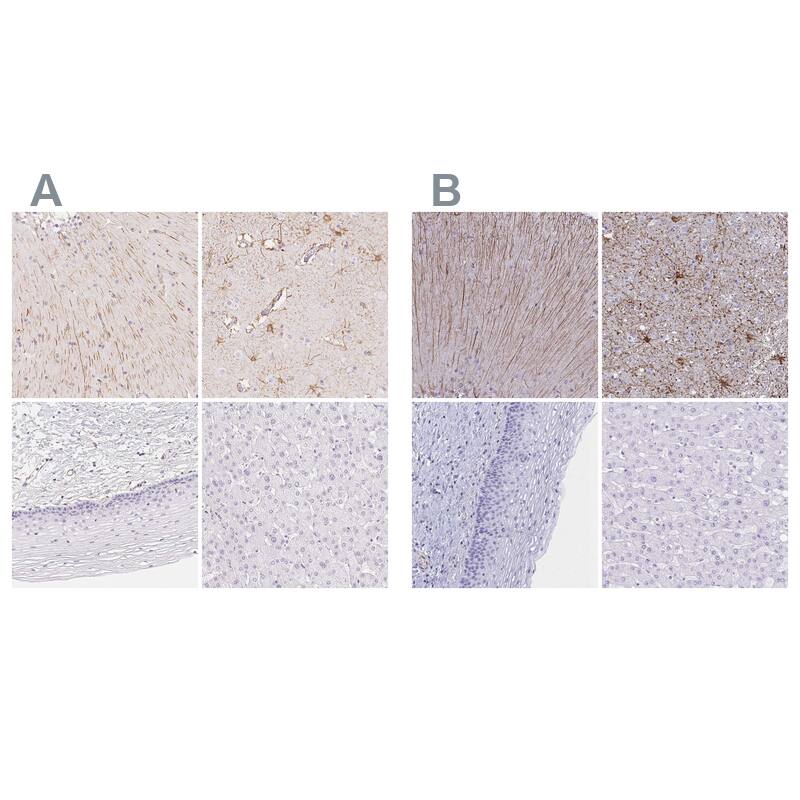 GFAP Antibody Immunohistochemistry-Paraffin: GFAP Antibody Antibody [NBP2-54748]