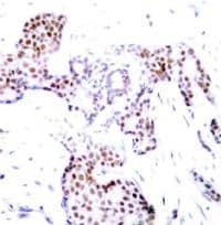 Elk-1 [p Ser389] Antibody - BSA Free