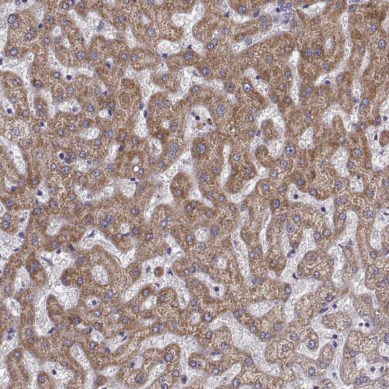 Kynurenine 3-Monooxygenase/KMO Antibody Immunohistochemistry-Paraffin: Kynurenine 3-Monooxygenase/KMO Antibody [NBP2-54915]
