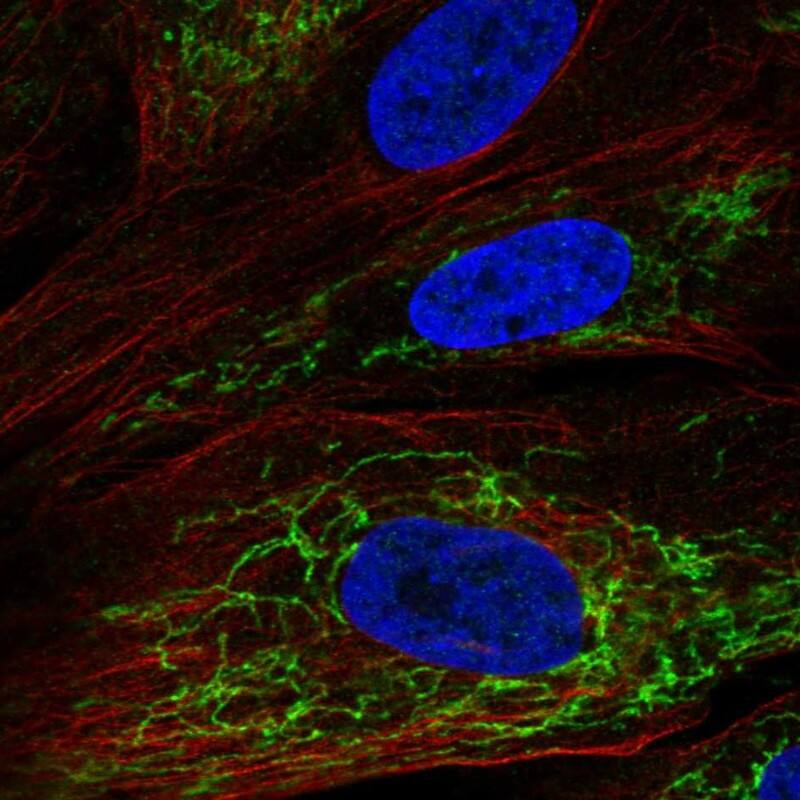 OSAP Antibody - BSA Free Immunocytochemistry/ Immunofluorescence: OSAP Antibody [NBP2-54955]