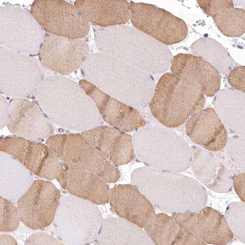 Aminopeptidase B/RNPEP Antibody - BSA Free Immunohistochemistry-Paraffin: Aminopeptidase B/RNPEP Antibody [NBP2-54975]